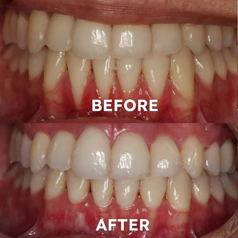 Ourlyard™ Tooth Powder