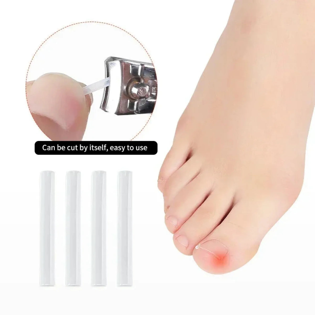 Toenail Relief Strips set