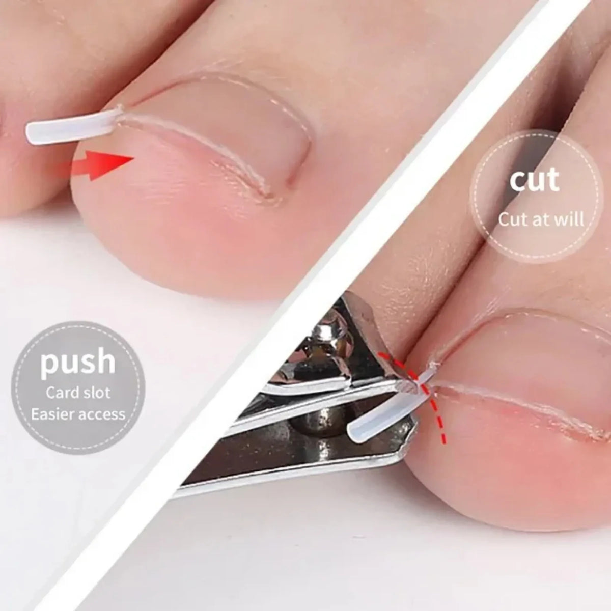 Toenail Relief Strips set