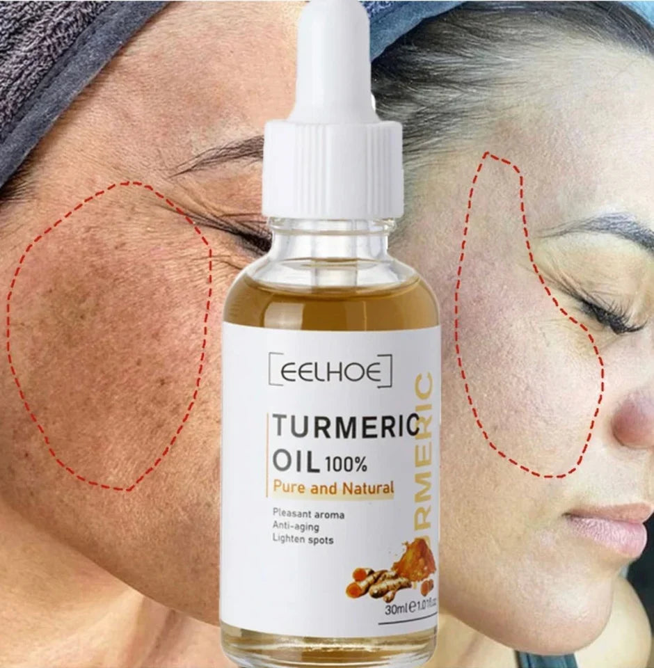 Turmeric Dark Spot Corrector Serum